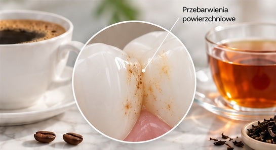 Ilustrační obrázek – zabarvení